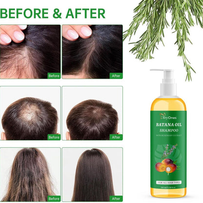 TryOnes BATANA OIL SHAMPOO with Rosemary Extract (Pack of 2)